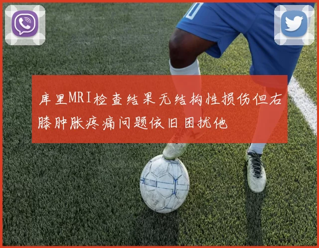库里MRI检查结果无结构性损伤但右膝肿胀疼痛问题依旧困扰他